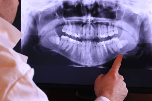 Best Tooth Infection Emergency Dentist  in Nazareth, PA